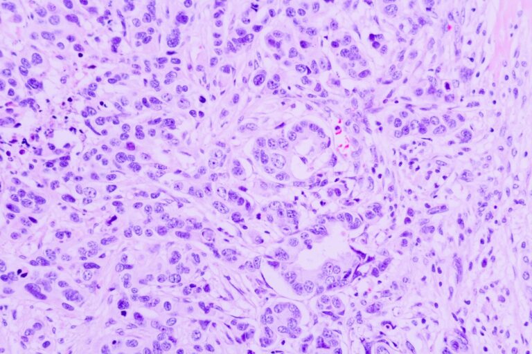 Backgrounds,Of,Human,Cells,Tissue,Of,Lung,Human,Under,The