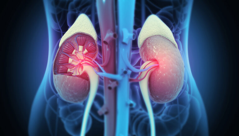 Chronic Kidney Disease. Medical organ. Cross section
