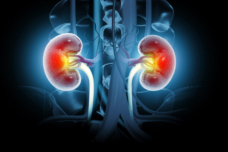 Human kidneys anatomy structure, kidney disease