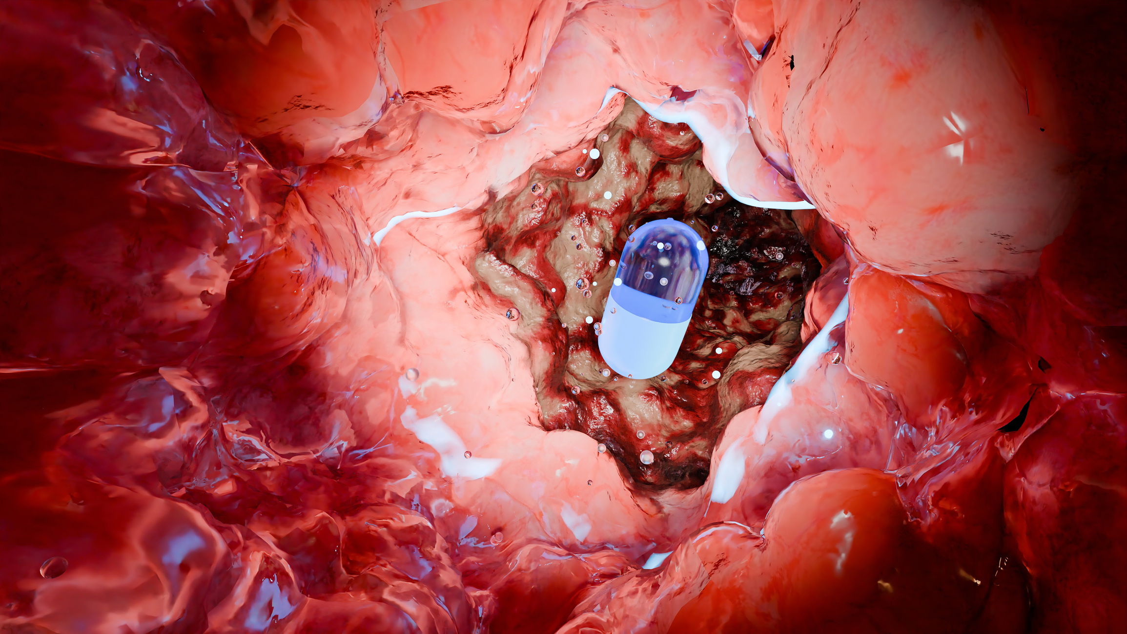 Vibrating Pill Could Both Treat Eating Disorders and Predict Relapse